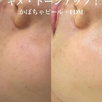 ブログ