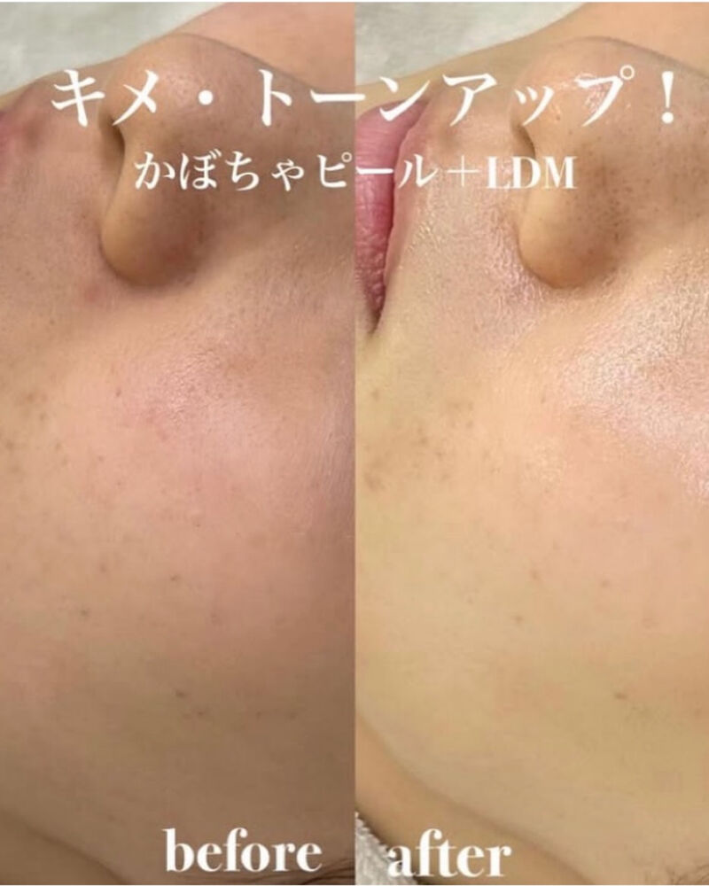 ブログ