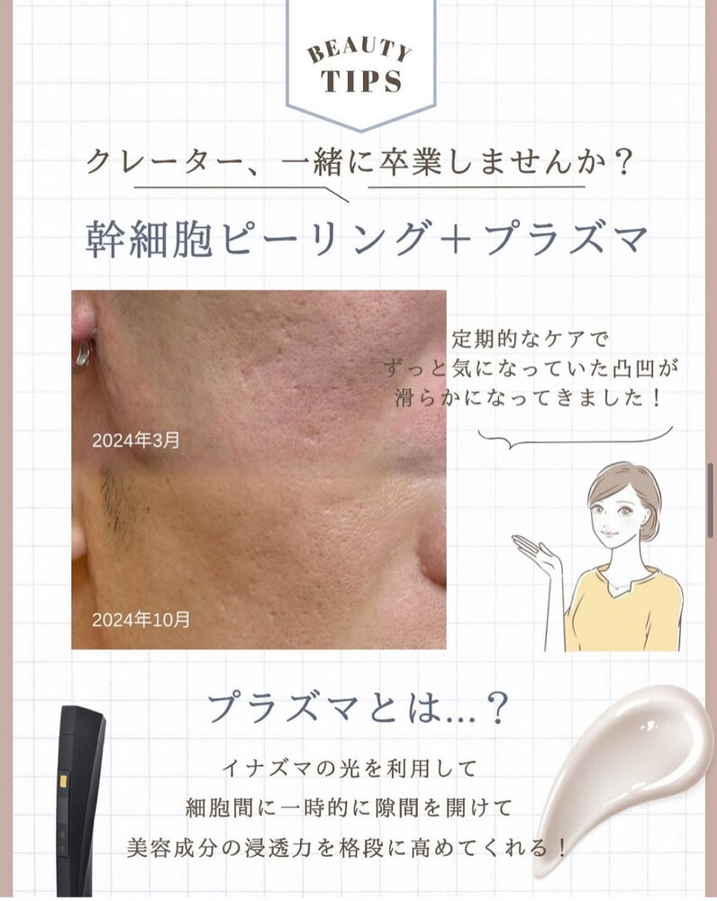 ブログ
