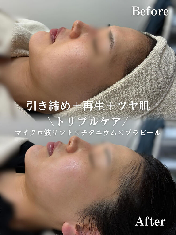 ブログ