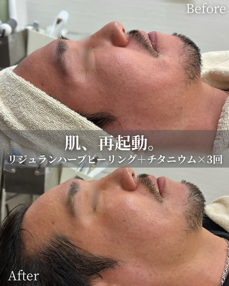 ブログ